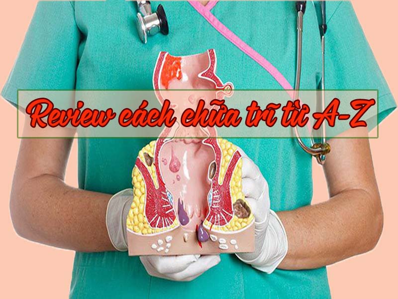 Tổng hợp 15+ các cách chữa bệnh trĩ từ A-Z: Hiệu quả, đơn giản, tốt nhất